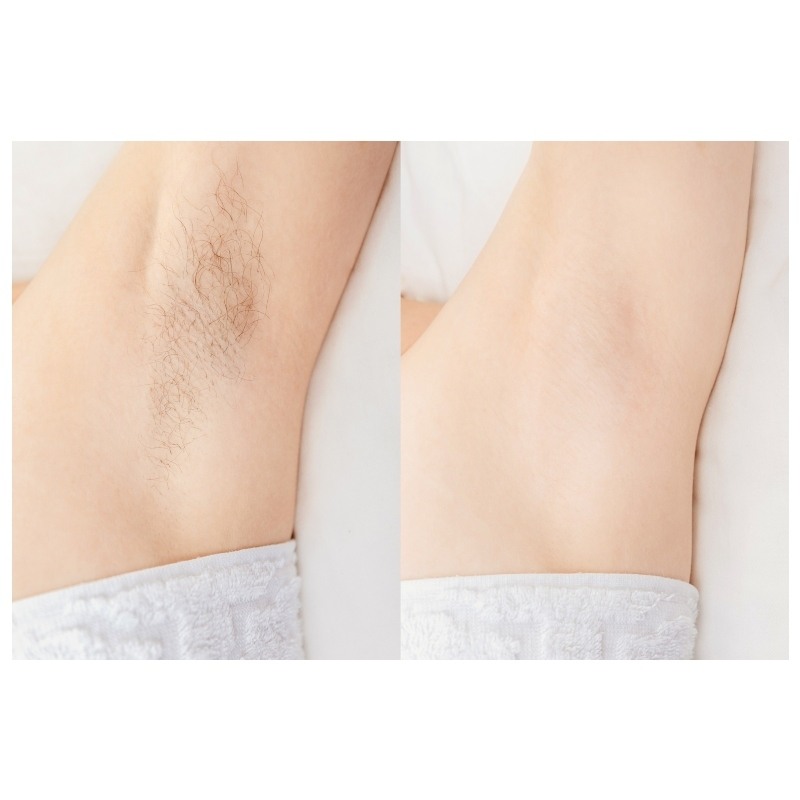 Hevi Sugaring Bodysugaring 600 gr.