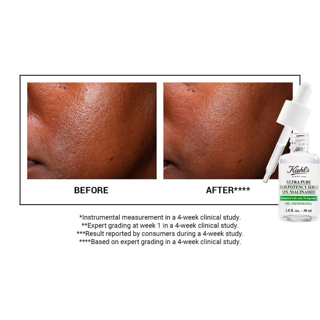 KIEHL'S Pure Serums Ultra Pure High-Potency Serum 5.0% Niacinamide - 30ml