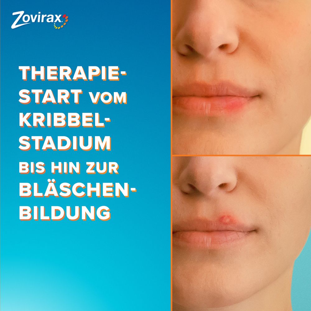 Zovirax Lippenherpescreme. 5 % Aciclovir. 2 g Packung.