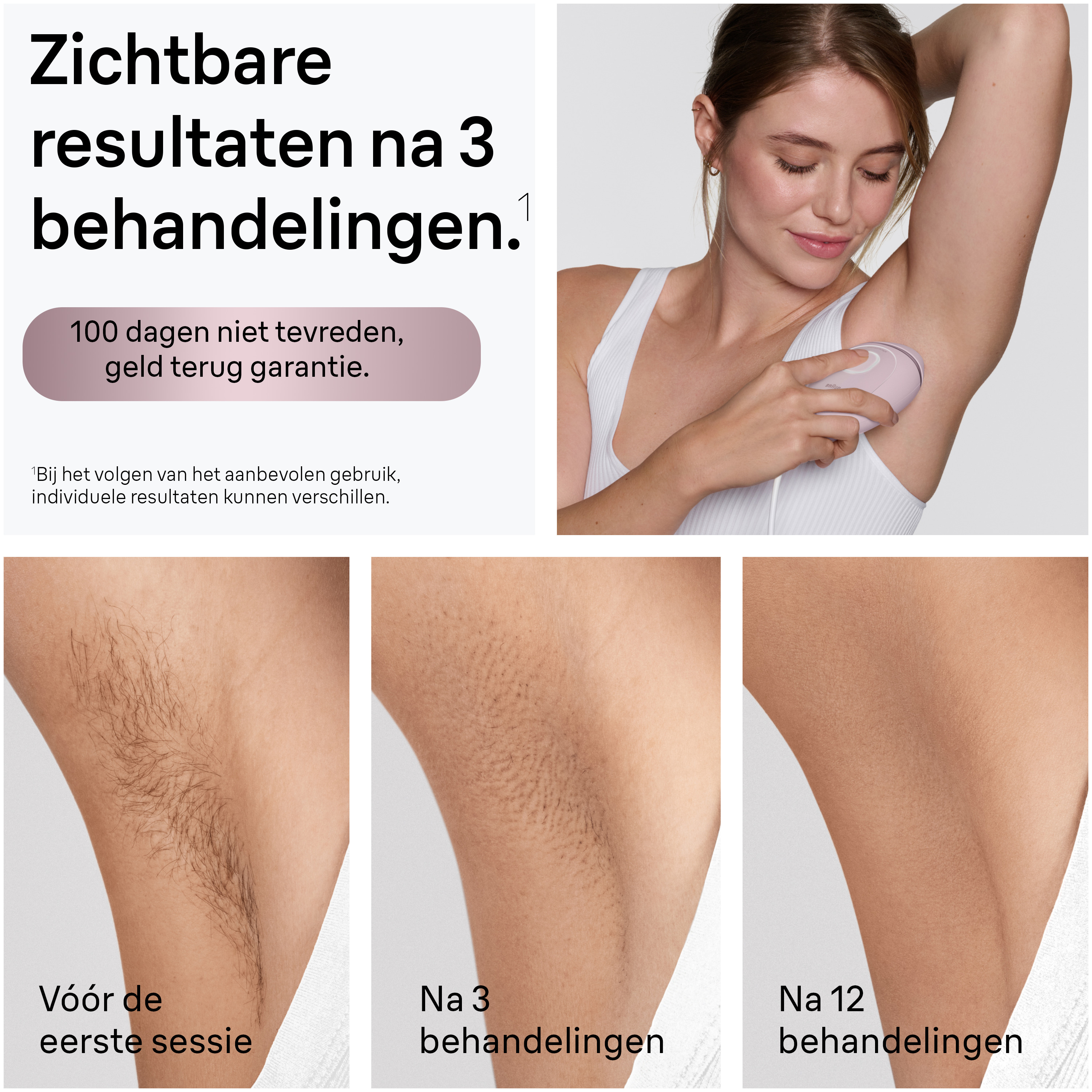 Braun Silk·expert Mini PL1100 IPL