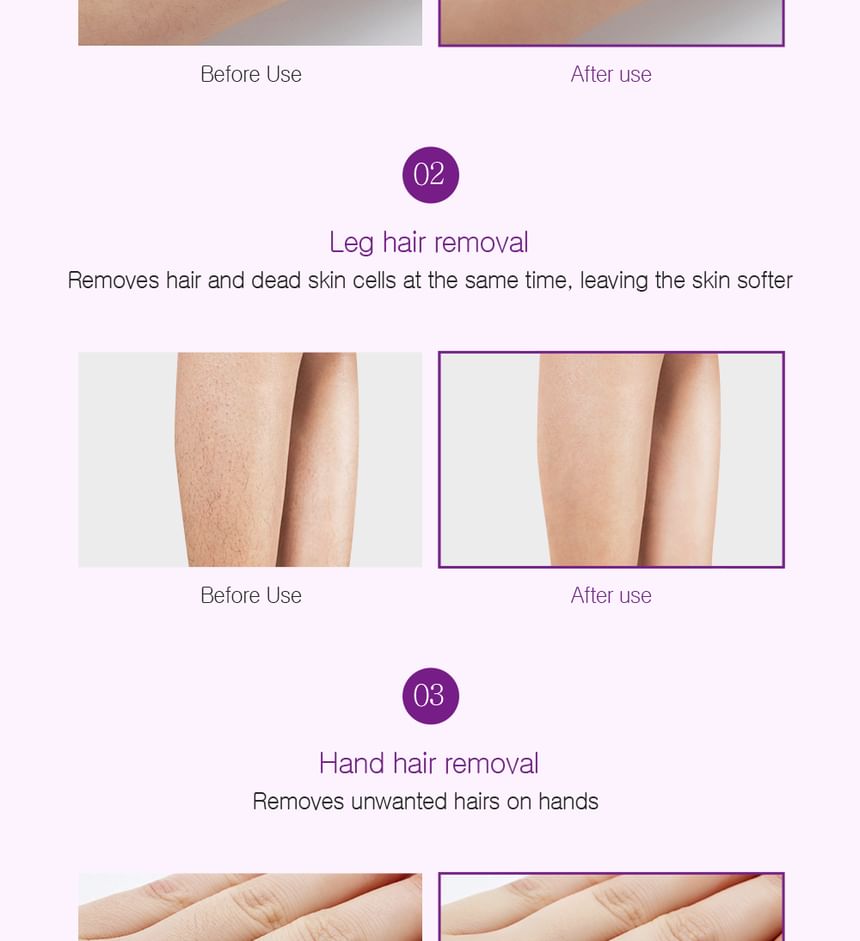 Derma: B - Milde Verwijderingscrème