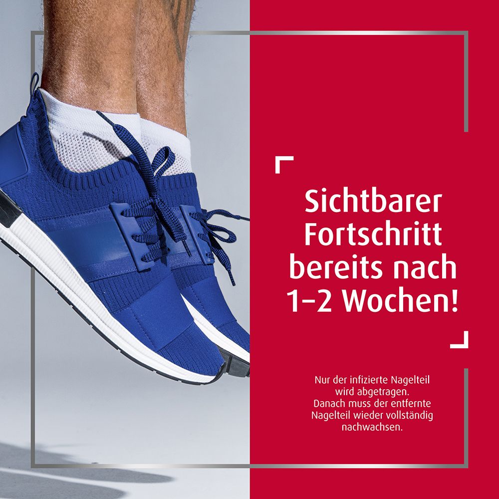 Canesten® EXTRA Nagelset zur Behandlung von Nagelpilz