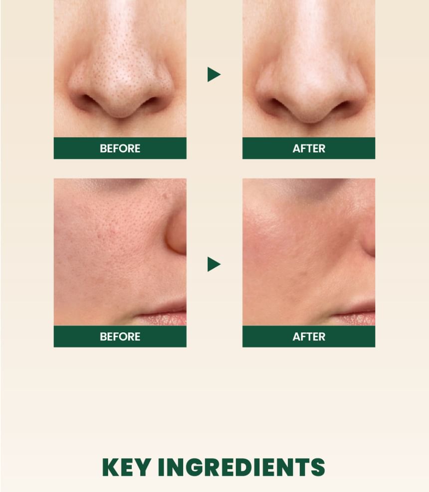 KSECRET - SEOUL 1988 Reinigingsschuim: Pine Cica 1% + Probiotica