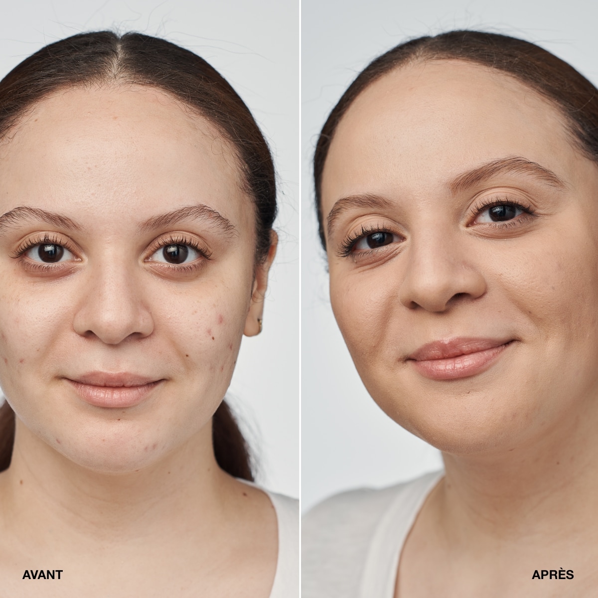 CLINIQUE Even Better Clinical Serum Foundation SPF 20 Fond de Teint