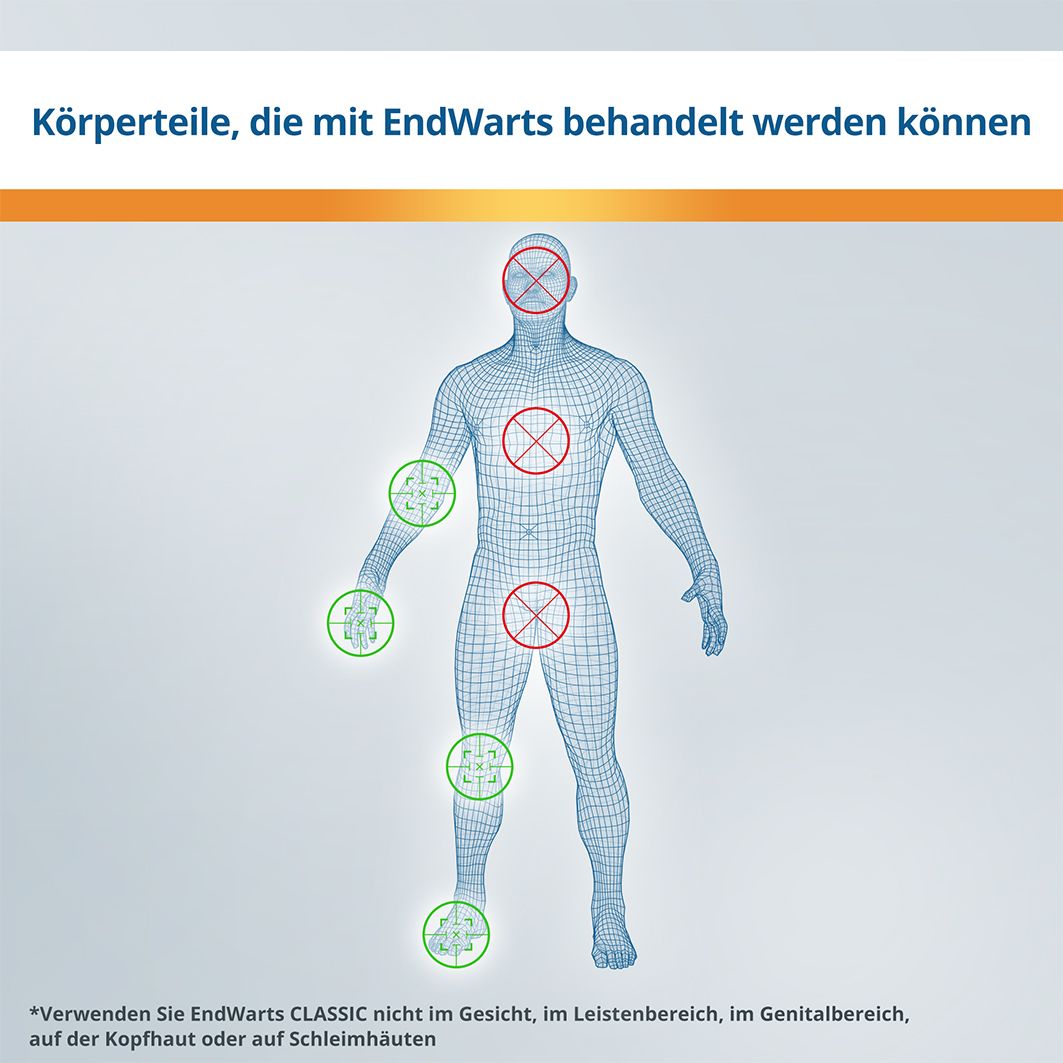 EndWarts CLASSIC: Lösung mit Ameisensäure gegen Warzen und Dornwarzen, Warzenbehandlung für Hände und Füße