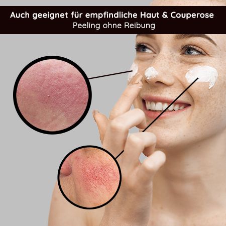 RAU Cosmetics Fruit Acid AHA, 2% BHA, PHA Fruchtsäurepeeling inkl. Neutralizer gegen Mitesser, Akne