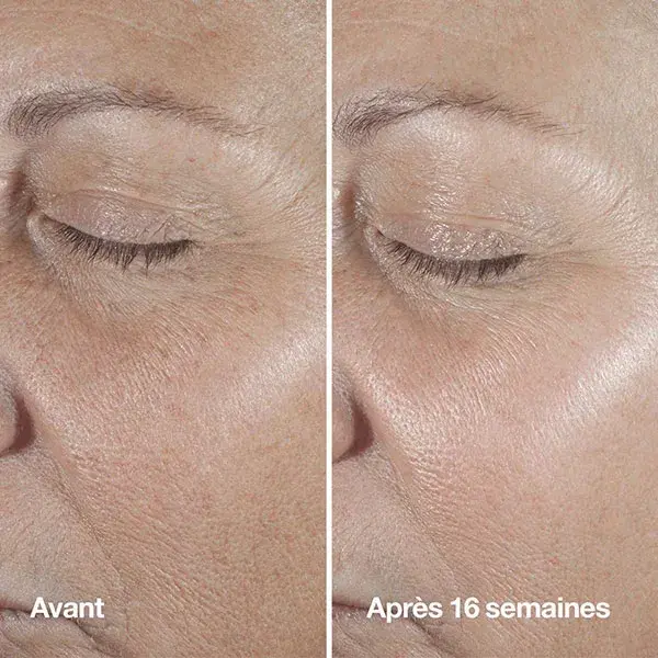 Clinique Smart Clinical Repair™ Routine Anti-Rides