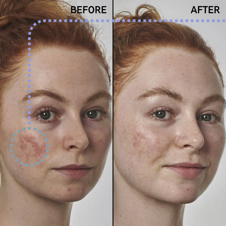 THE INKEY LIST Redness Solution with 10% Azelaic - Face Serum