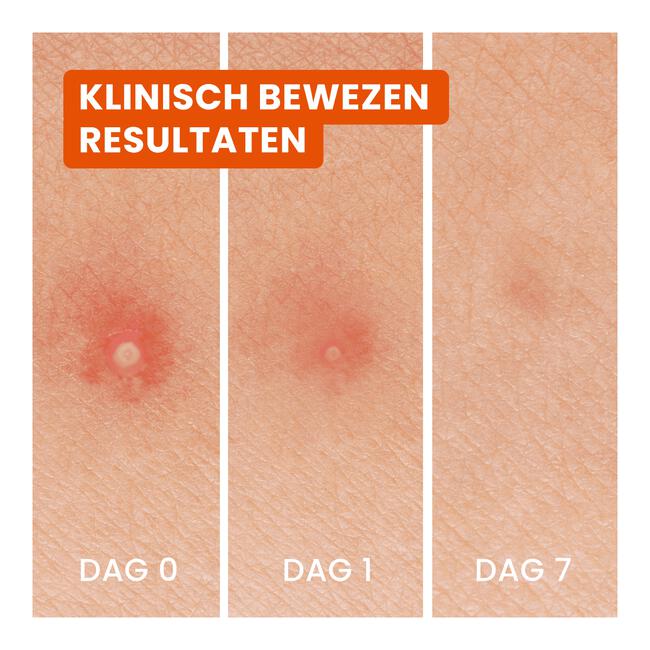 Bioré Hydrocolloid Patch 24 stuks