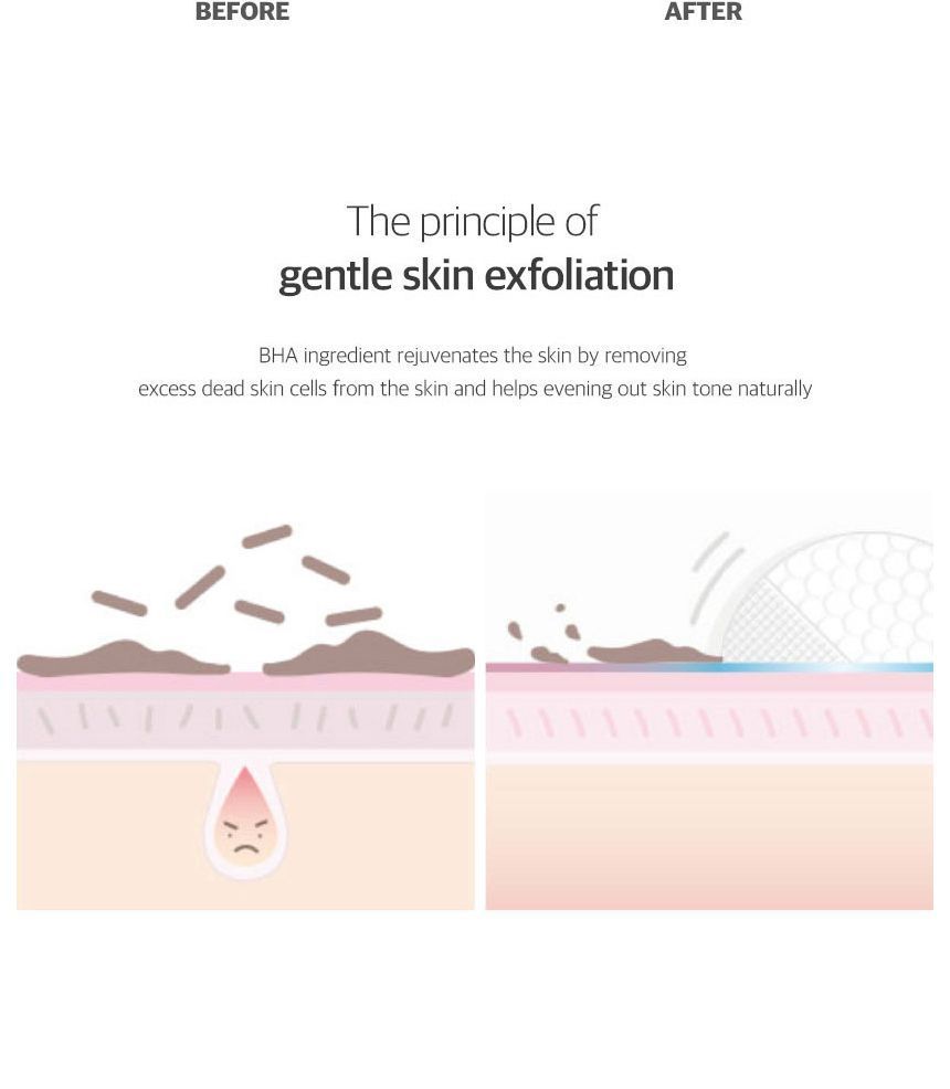 celimax - JIWOOGAE Heartleaf BHA Peeling Pad