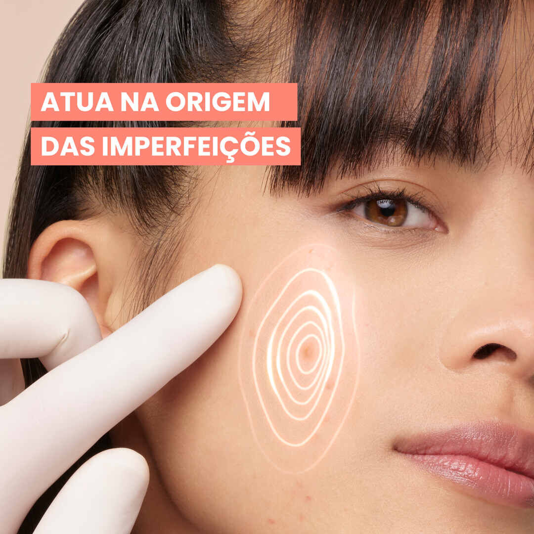 AVENE  Cleanance Comedomed+ Concentrado Anti-imperfeições - 30ml