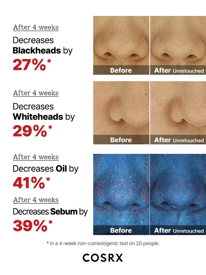 The AHA 2 BHA 2 Blemish Treatment Serum
