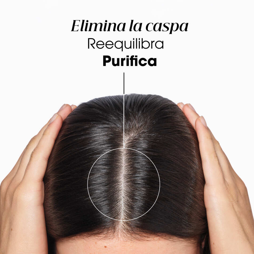 KLORANE  Galanga Champô Anticaspa Reequilibrante - 200ml