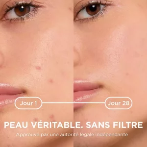 Sebium Kerato+ Gel-crème anti-imperfections - 30ml