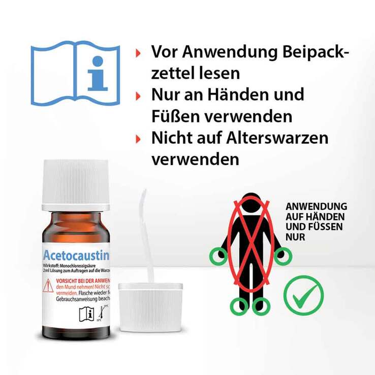 Acetocaustin Lösung Warzenmittel, 2 ml