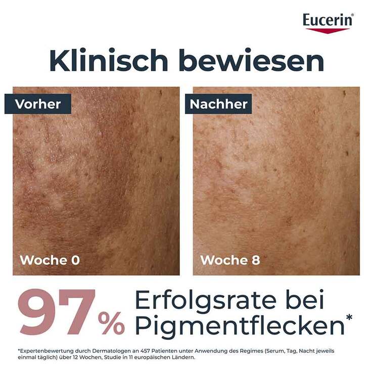 Eucerin Anti-Pigment Tagescreme LSF 30, 50 ml