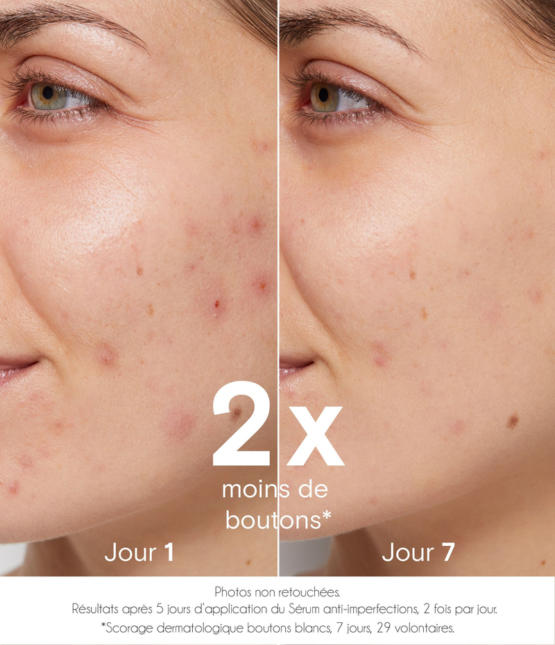 Sérum purifiant anti-imperfections - La Rosée