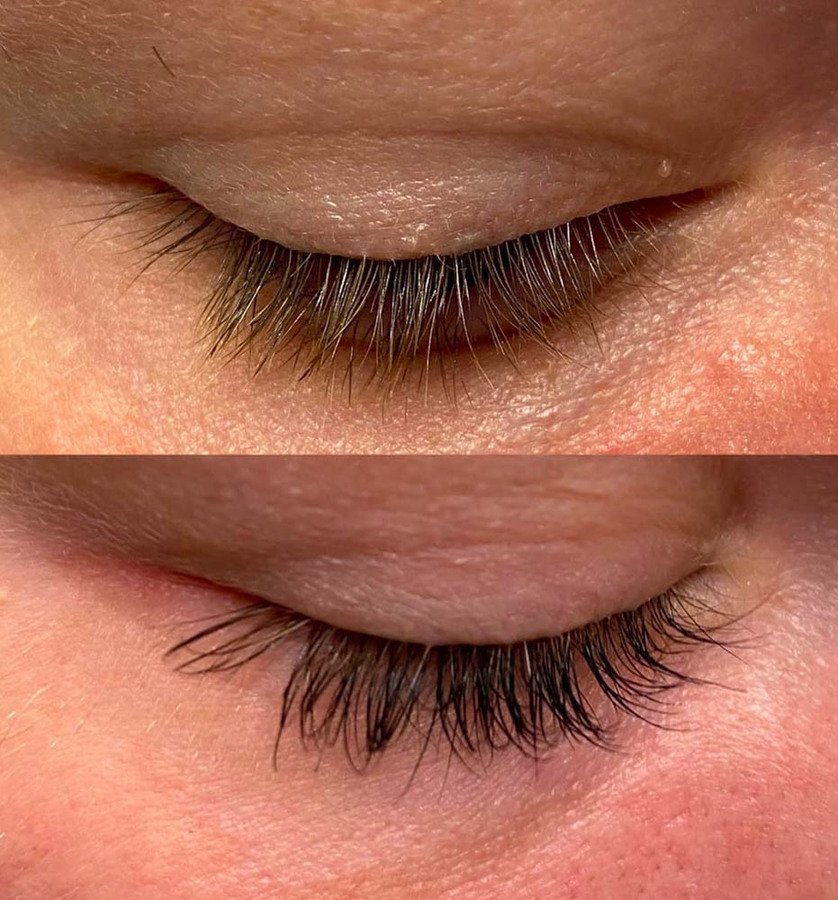 Lenoites ® Eyelash Activating Serum 5ml