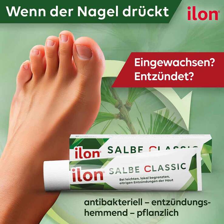 ilon Salbe classic, 100 g