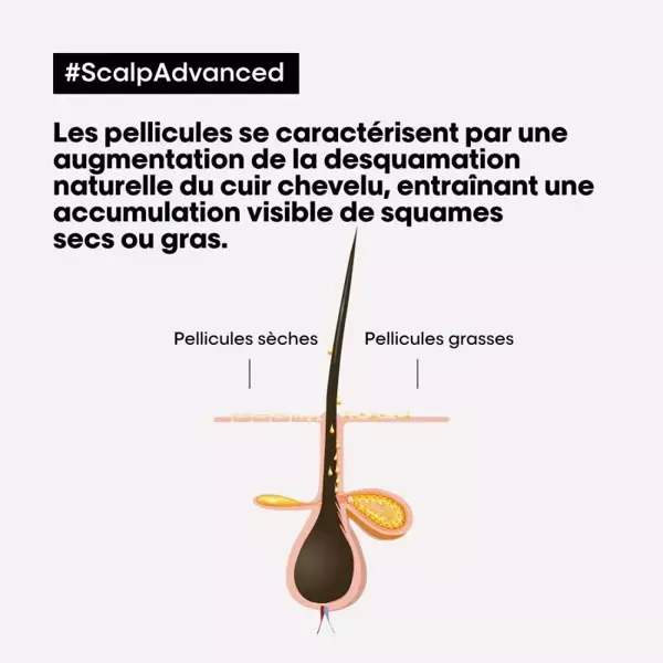 L'Oréal Professionnel Serie Expert Scalp Advanced Shampoo Dermo-Clarificante Anticaspa 500ml