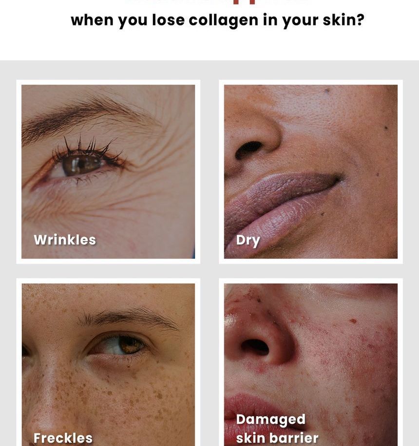 KSECRET - Collageen Vita Secret Multi Balsem