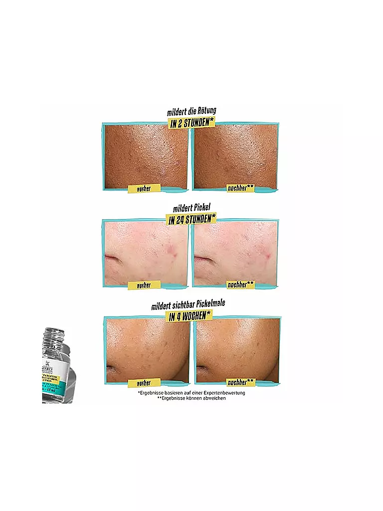 KIEHL'S Truly Targeted Blemish Clearing Solution 15ml keine Farbe
