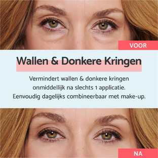 Remescar Wallen en Donkere Kringen Crème 8ML