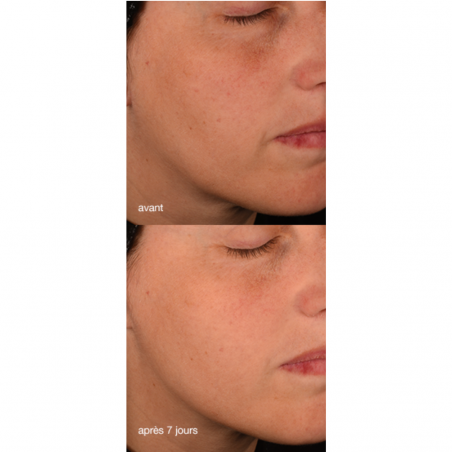 Dermalogica Pro-collagen banking serum