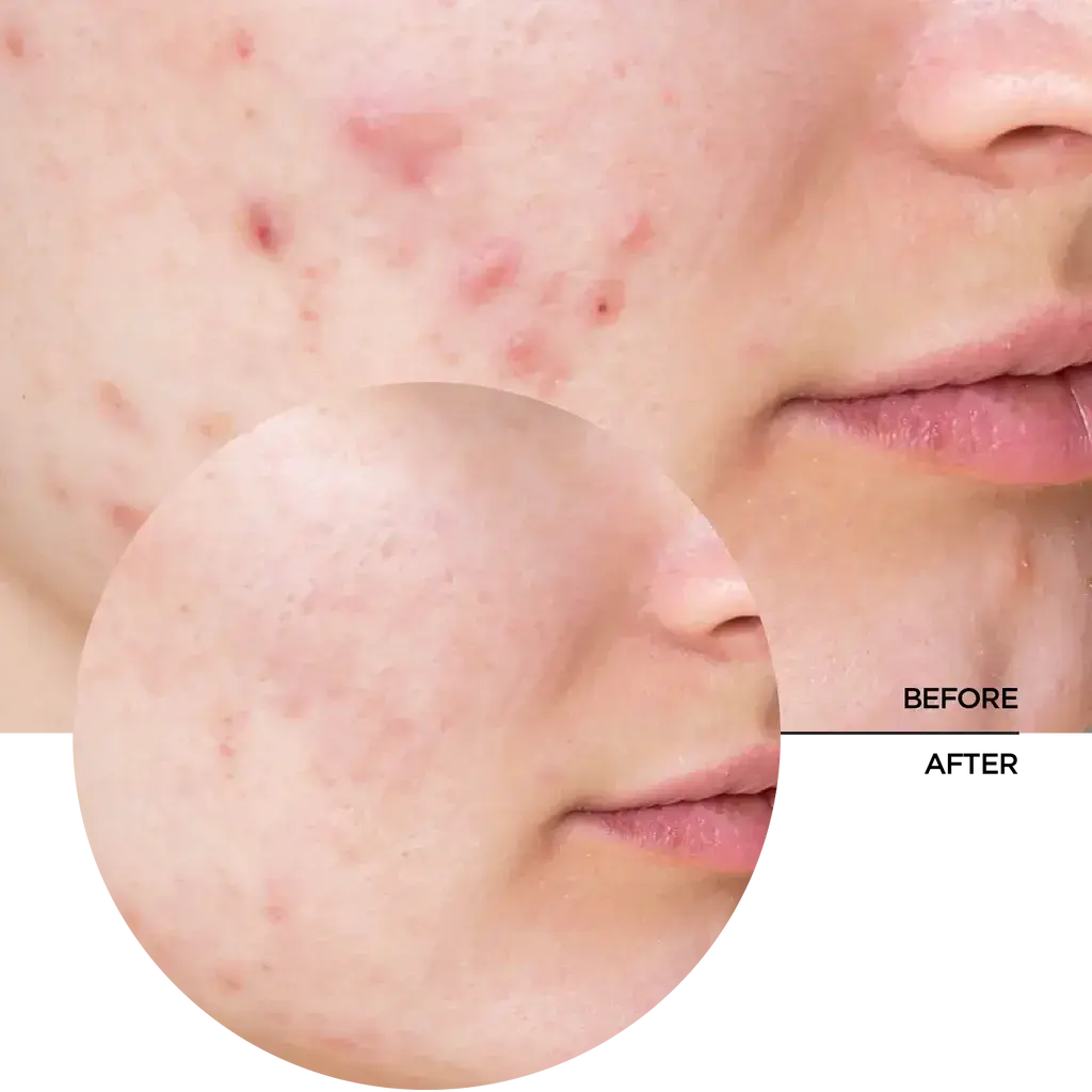 Just Niacinamide 10%