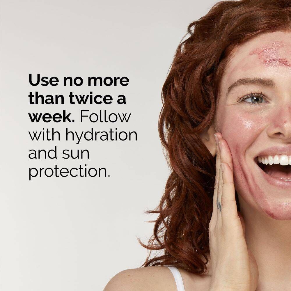The Ordinary AHA 30% + BHA 2% Peeling Solution