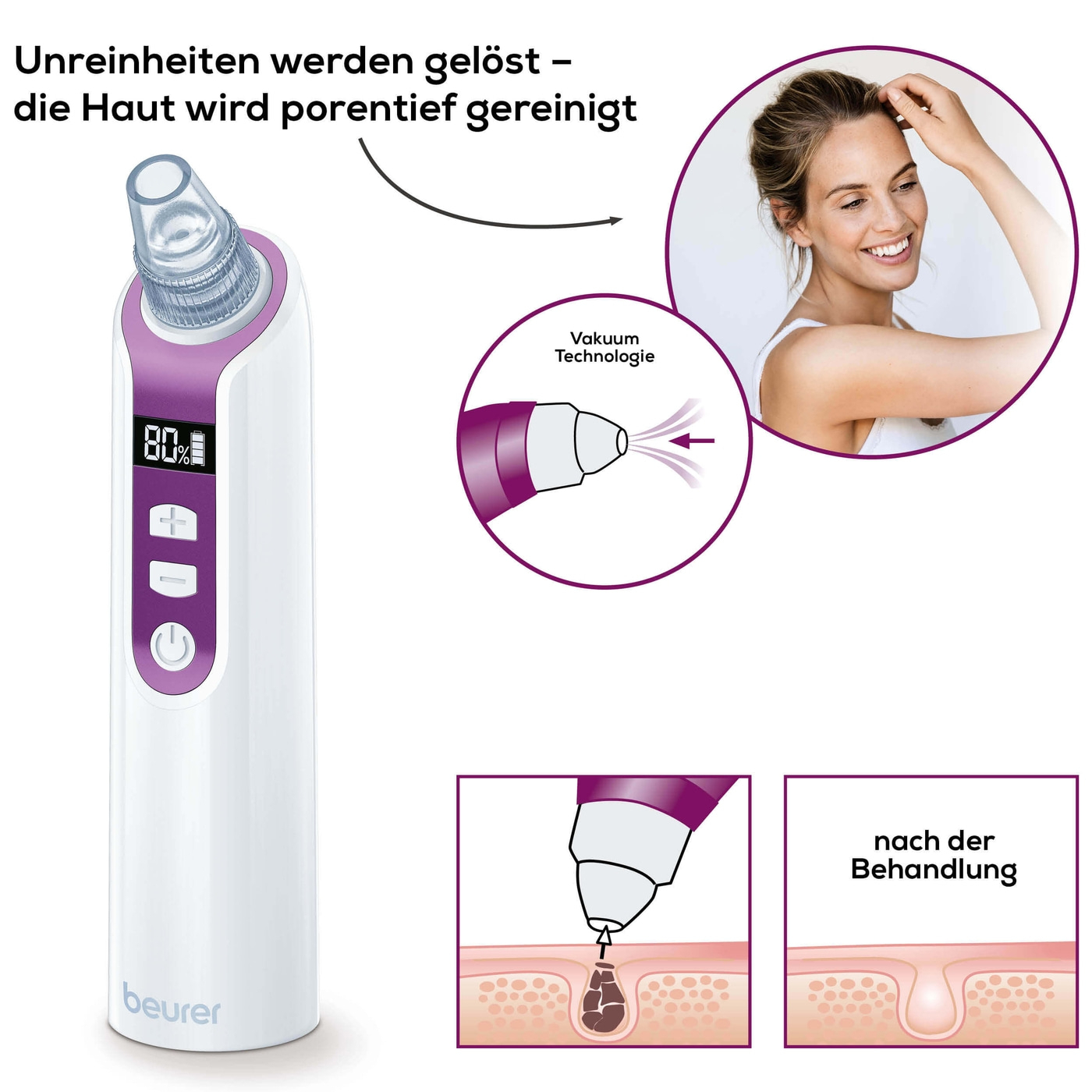 FC 41 Multifunktioneller Porenreiniger Vakuum Gesichtsreiniger (58417) - Weiss / Lila