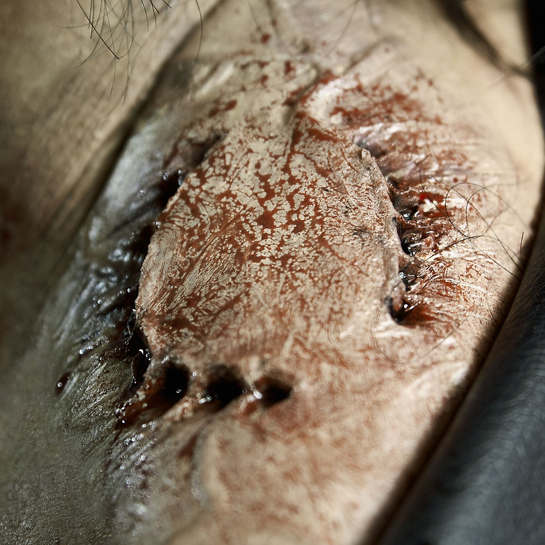 Exit Skin - Zombie Bite