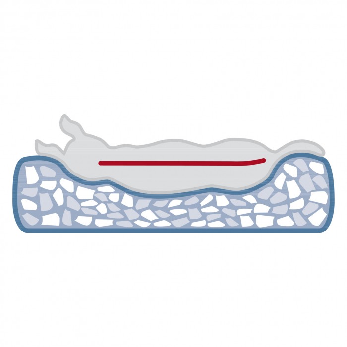 Abri Vital Noah