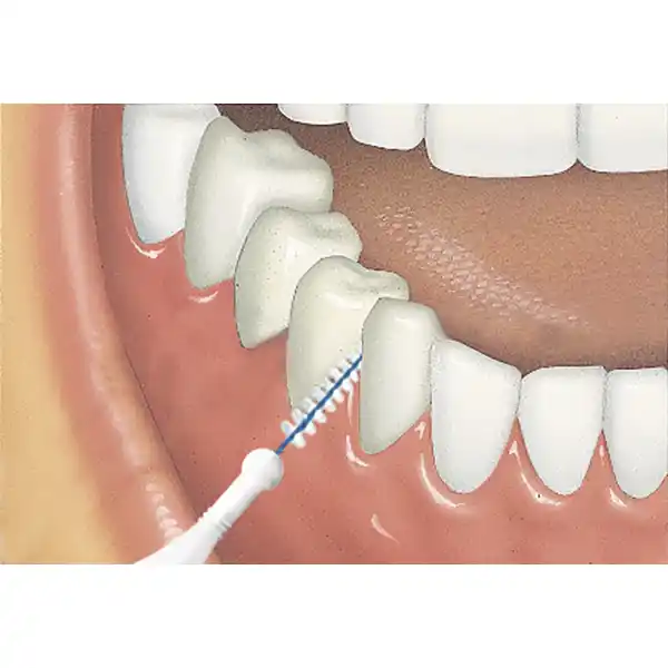 TRAV-LER® Interdentalbürste Kerze 0,6 mm hellblau