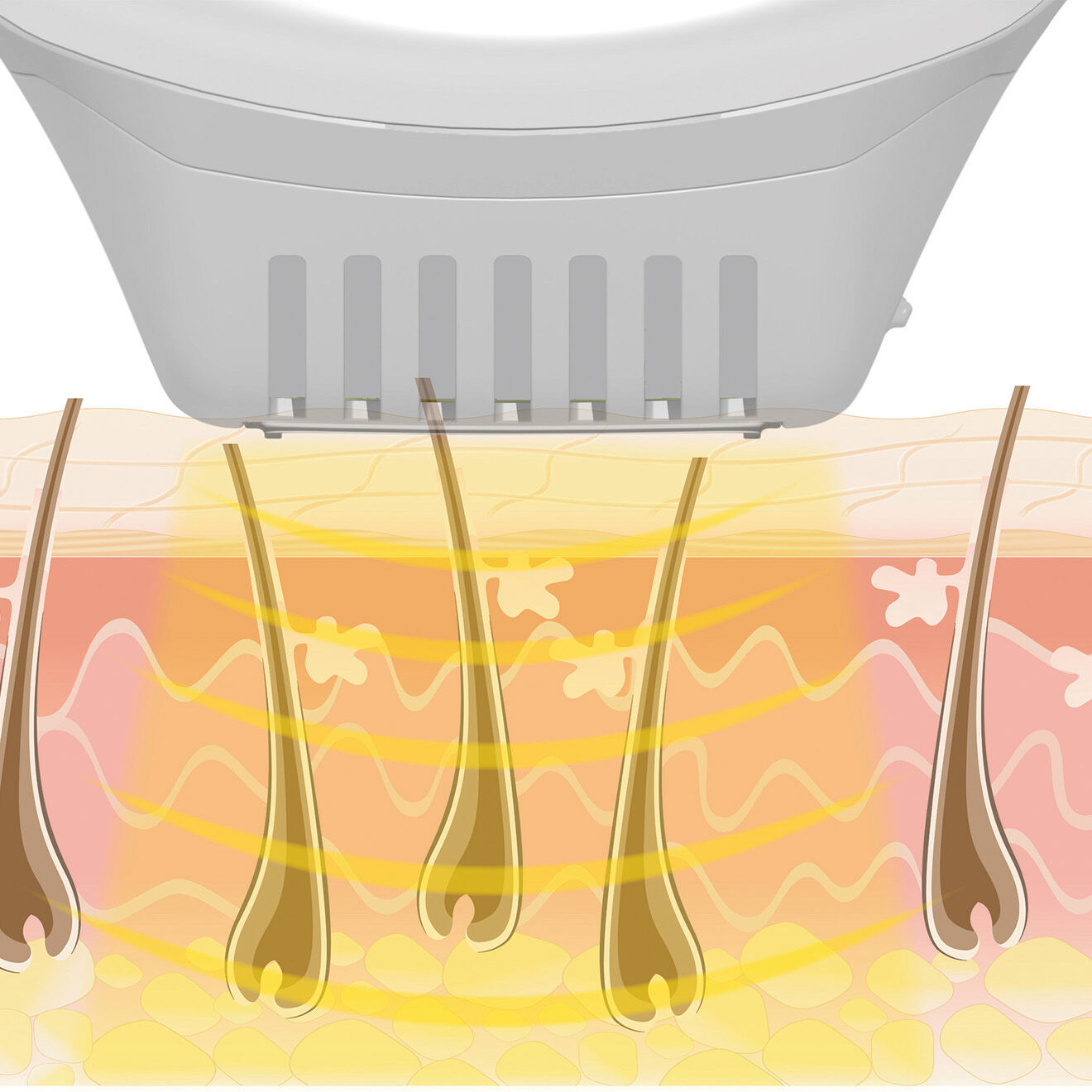 Beurer Épilateur à lumière pulsée  longue durée IPL 250 000 flash blanc