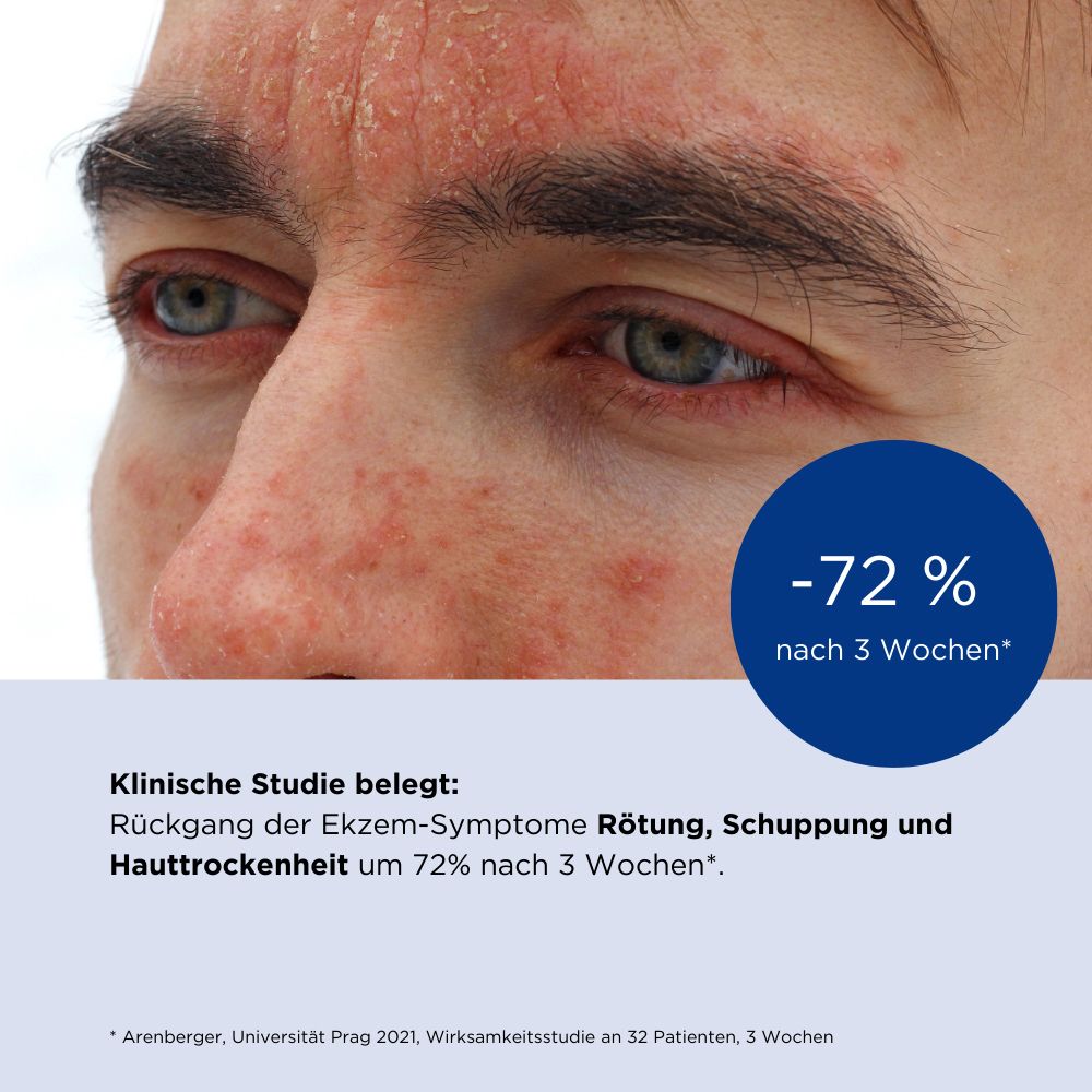 ALLERGIKA® Gesichtscreme MED - Jetzt 2 Euro sparen mit code ,,allergika2''