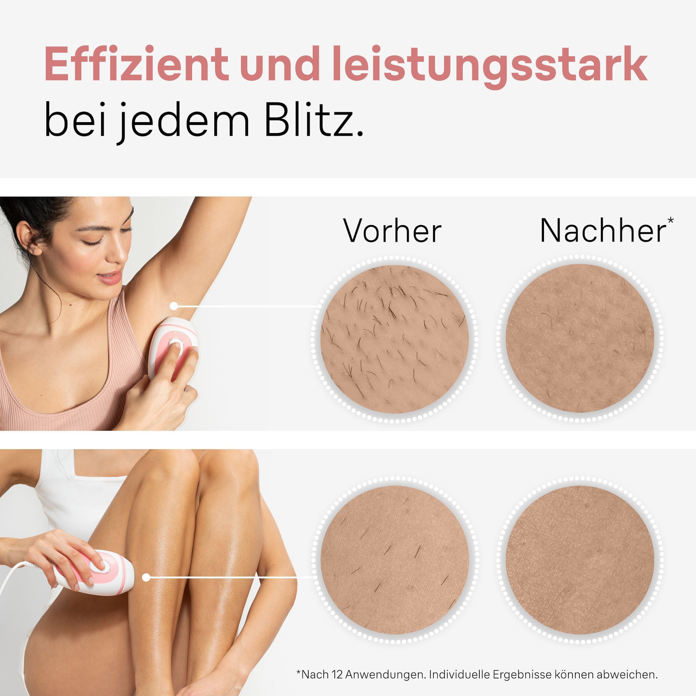 Braun IPL-Haarentferner »Silk-expert PL1000« Mini-Haarentfernungsgerät, kompakte Grösse für unterwegs