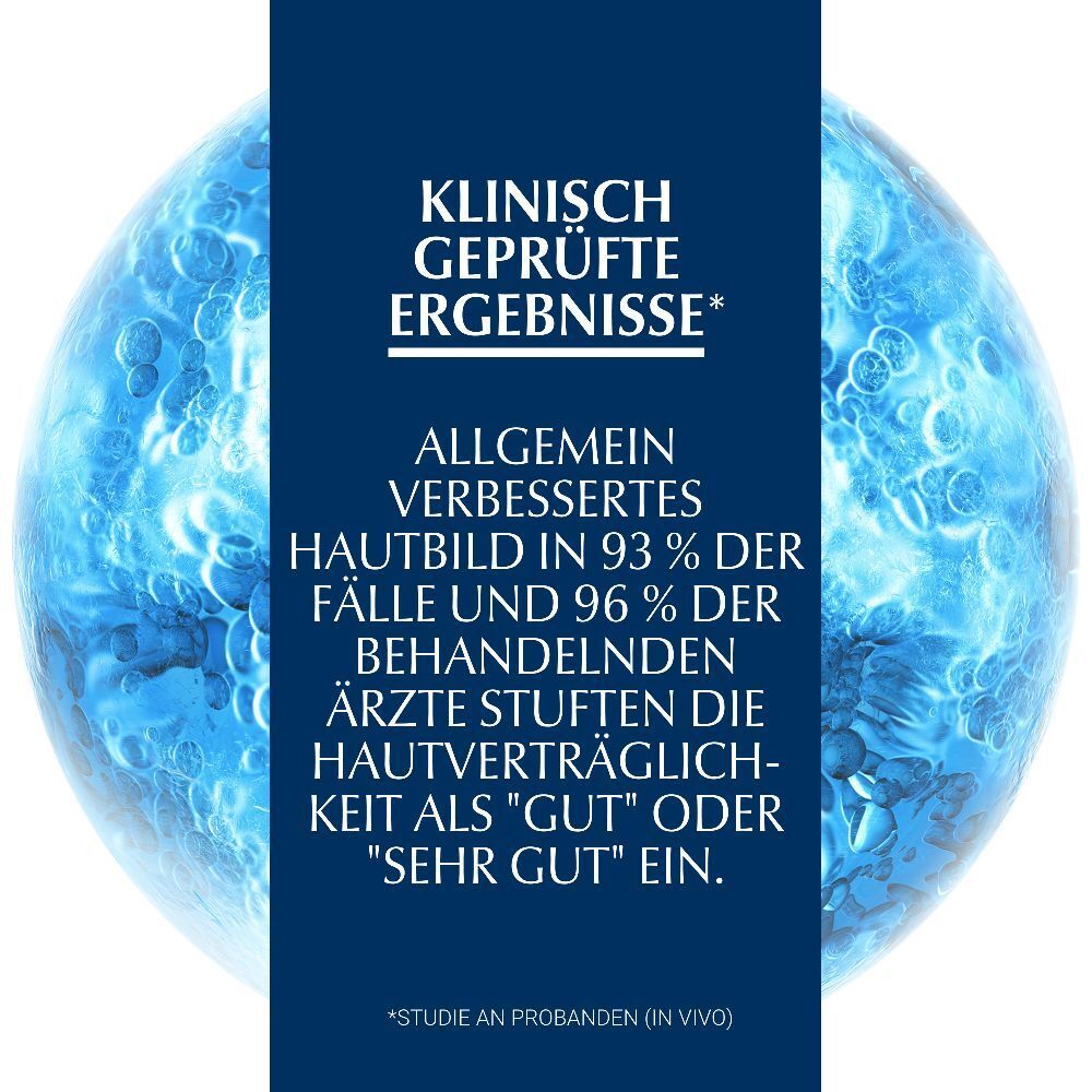 Eucerin® UreaRepair Original Creme 5% – Intensive Feuchtigkeit für trockene, raue und schuppige Hautstellen