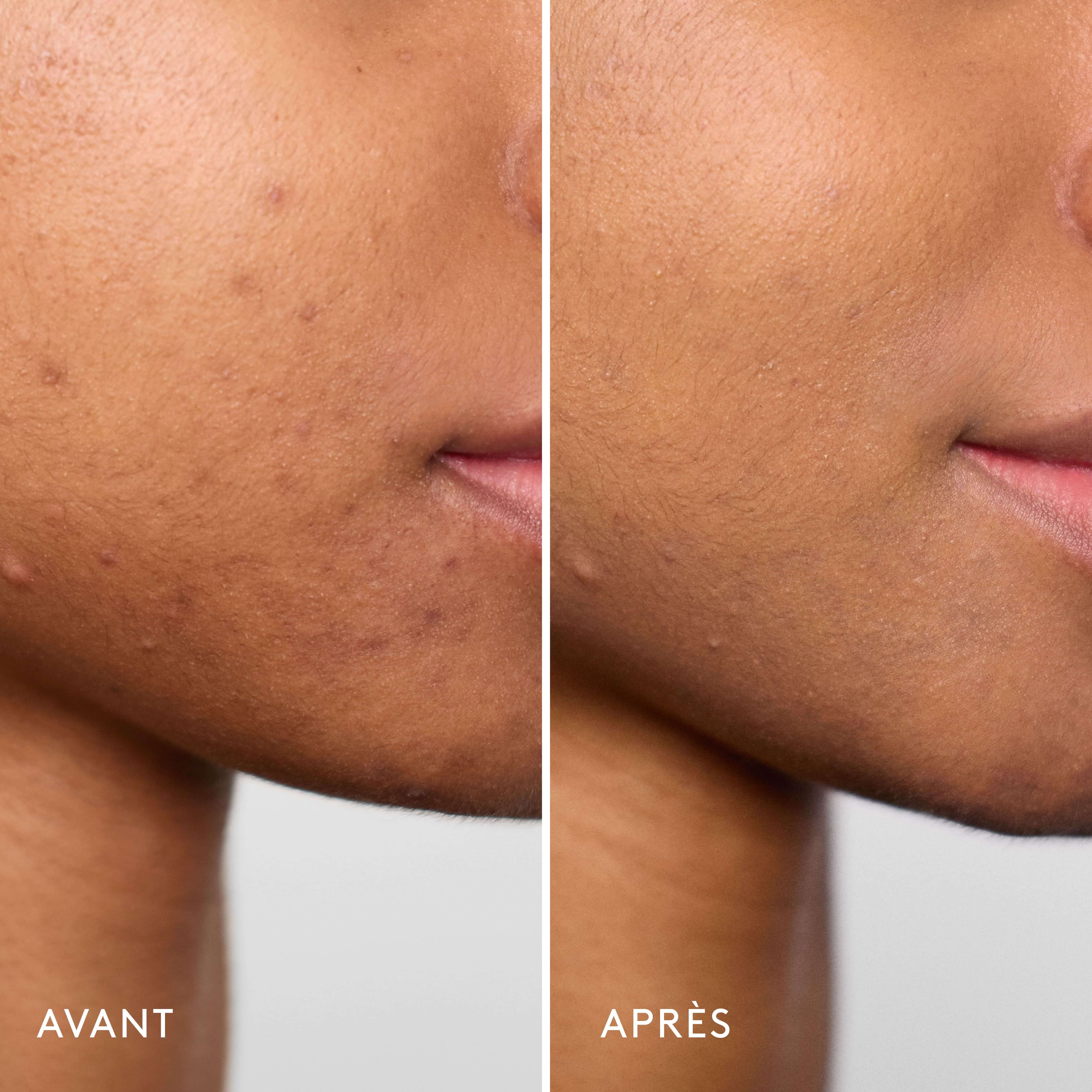 Violette_FR Invisible Bandage Gel Apaisant & Réparateur