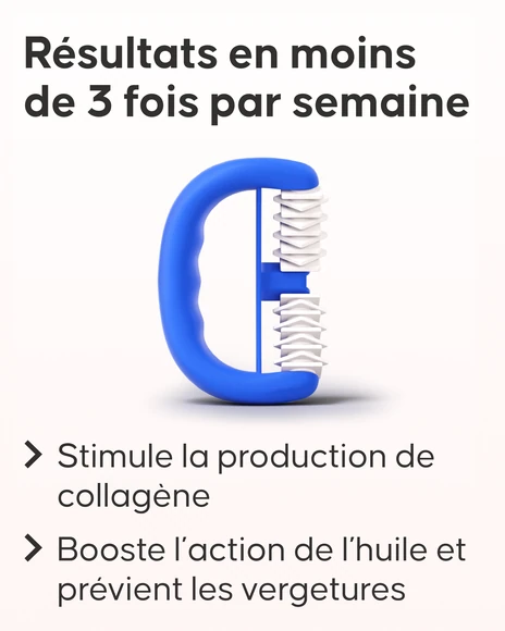 Rouleau Vergetures