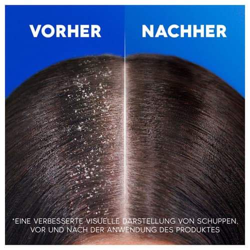 Head & Shoulders Citrus Fresh Anti-Schuppen-Shampoo Fettiges Haar