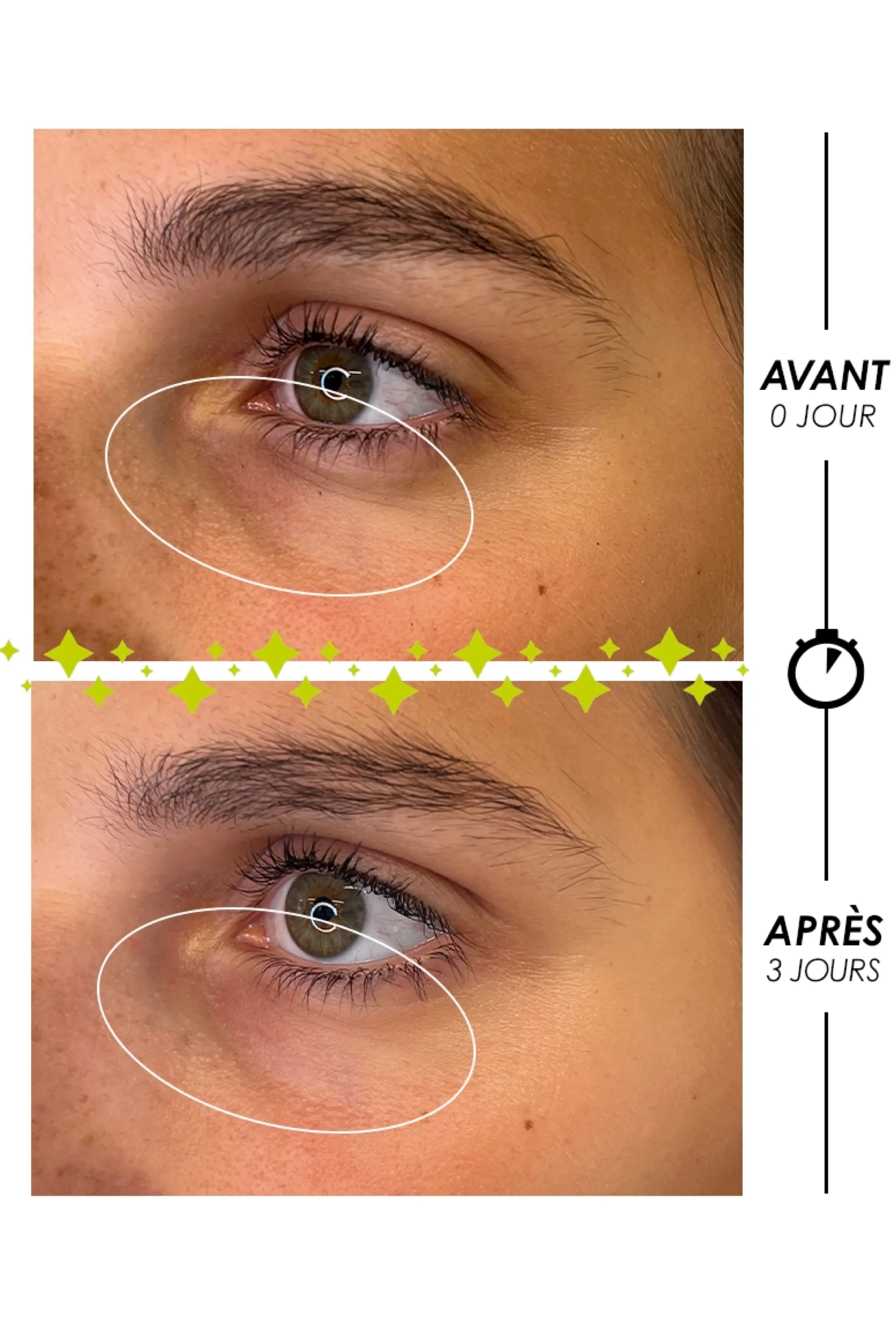 Garancia Roll-on contour des yeux anti-cernes anti-poches Larmes de Fantôme®-10 ml