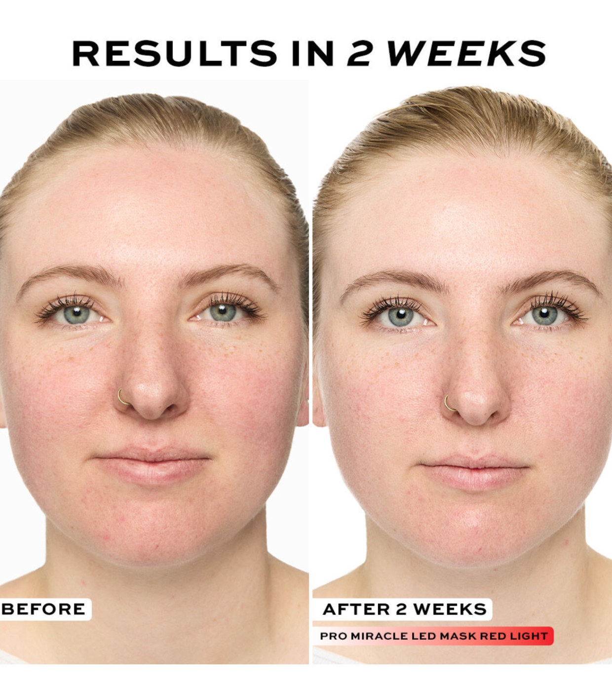 Revolution Pro - Máscara facial Miracle LED Face Mask