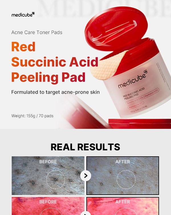 medicube - Rode barnsteenzuur peeling pad