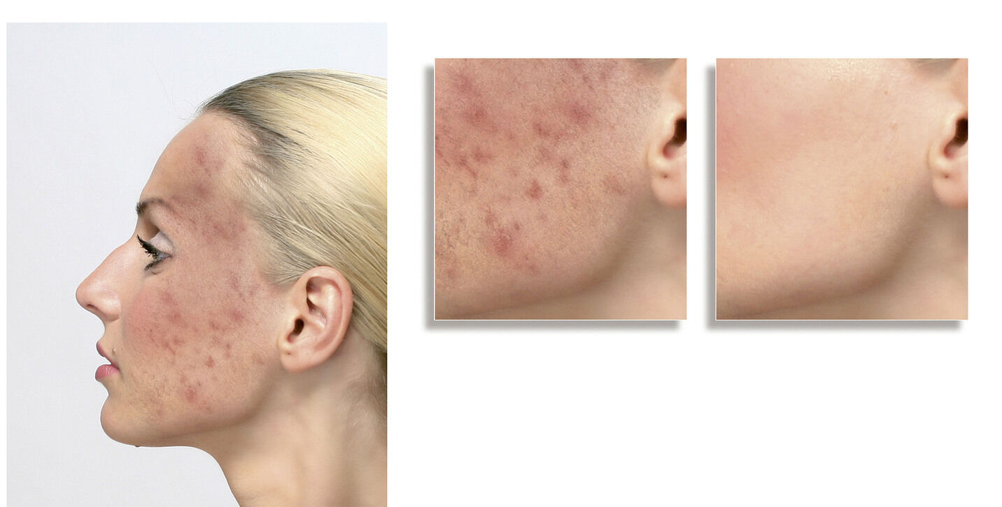 ELITE Cover Make-up