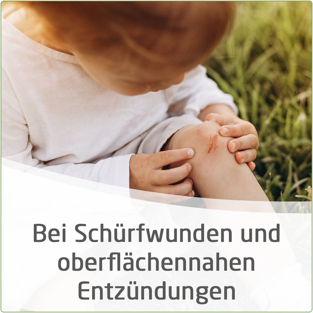 Calendula Wundsalbe zur wirksamen Behandlung von Schürfwunden und kleineren Hautverletzungen