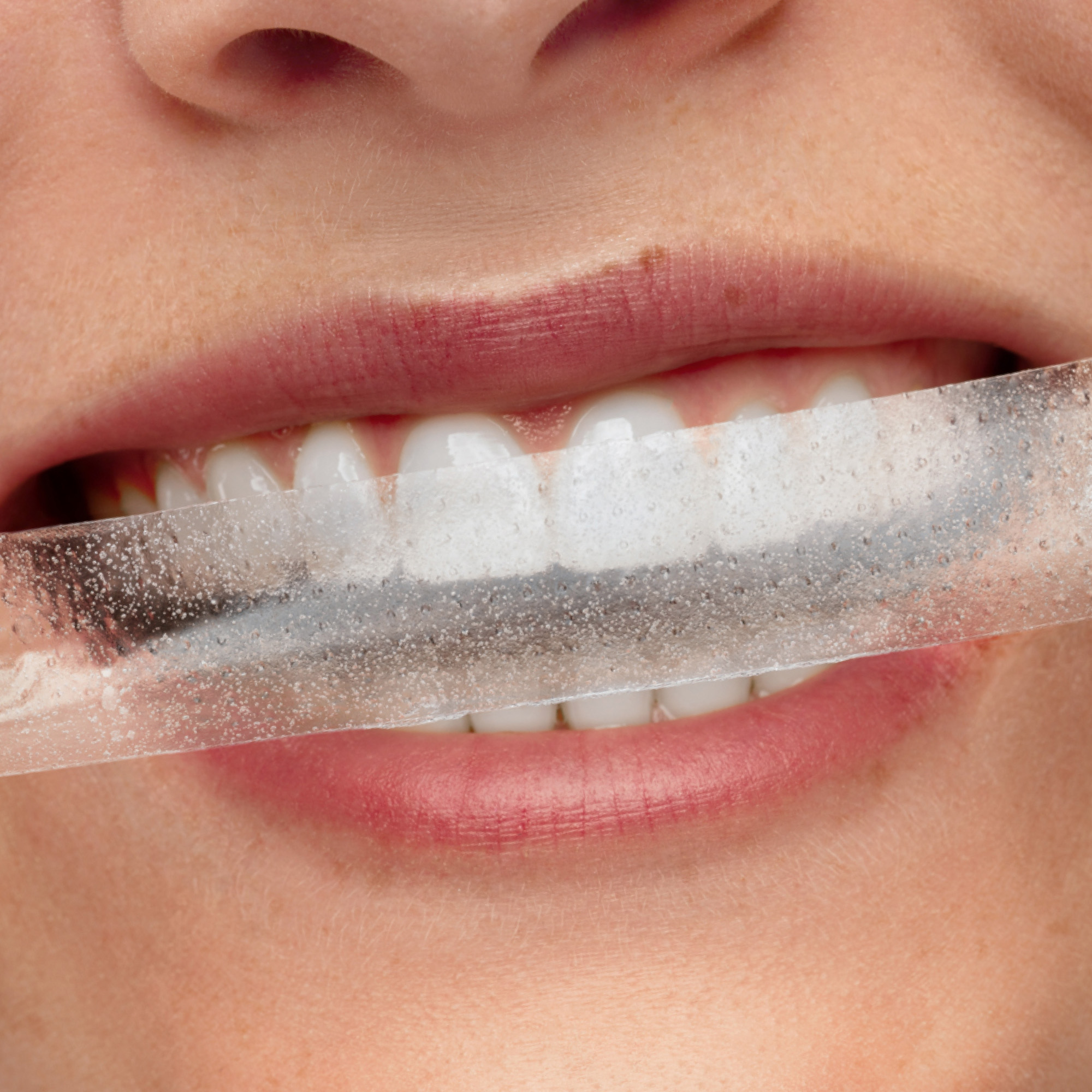 SmilePen Power Whitening Strips Kit 7x2 Strips 1x Whitening Accelerator 1 Stk