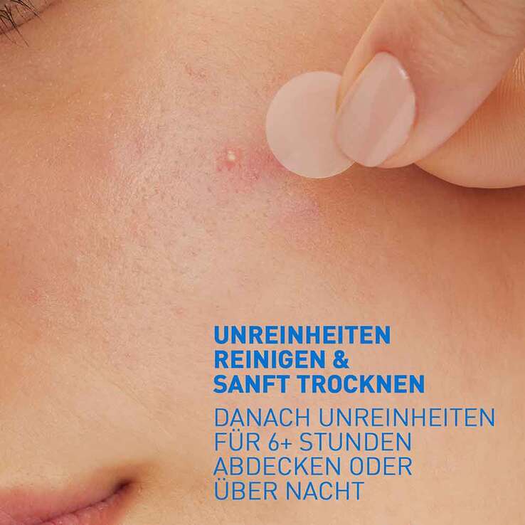 CeraVe Anti-Unreinheiten Patches, 22 St