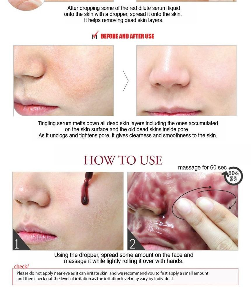 zo natuurlijk - Red Peel Tingle Serum