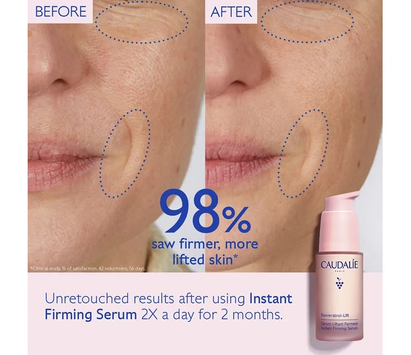 CAUDALIE Resveratrol-Lift Instant Lifting Serum